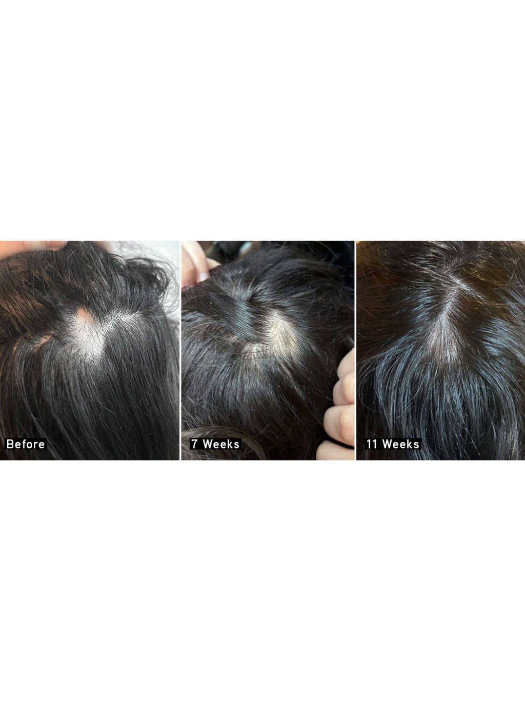 Iles Formula | Scalp + Hair Rejuvenating Booster - 50 ml